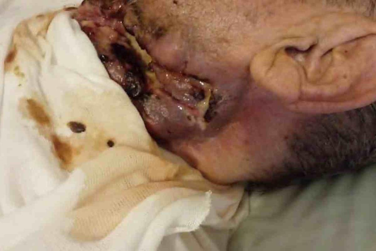 Abandono y horror en una clínica de La Plata: pacientes sin comida, oxígeno ni higiene y rodeados de hormigas