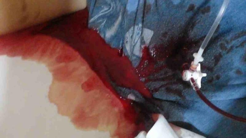 Abandono y horror en una clínica de La Plata: pacientes sin comida, oxígeno ni higiene y rodeados de hormigas